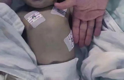 幼儿确诊铅中毒，毒源疑浮出水面，家长忧心忡忡